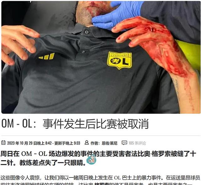 里昂在客场战胜梅斯,继续保持不败 里昂在客场战胜梅斯,继续保持不败